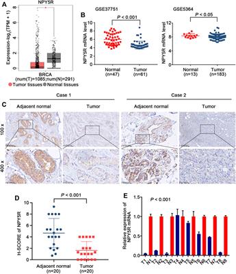 The Novel Methylation Biomarker NPY5R Sensitizes Breast Cancer Cells to Chemotherapy